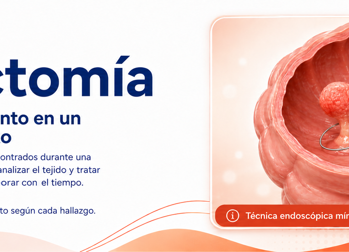 Polipectomía
