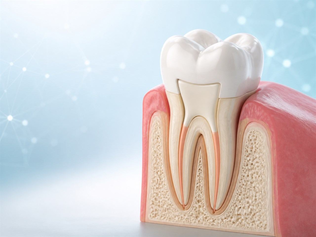 Molar restaurado y con sus conductos correctamente sellados