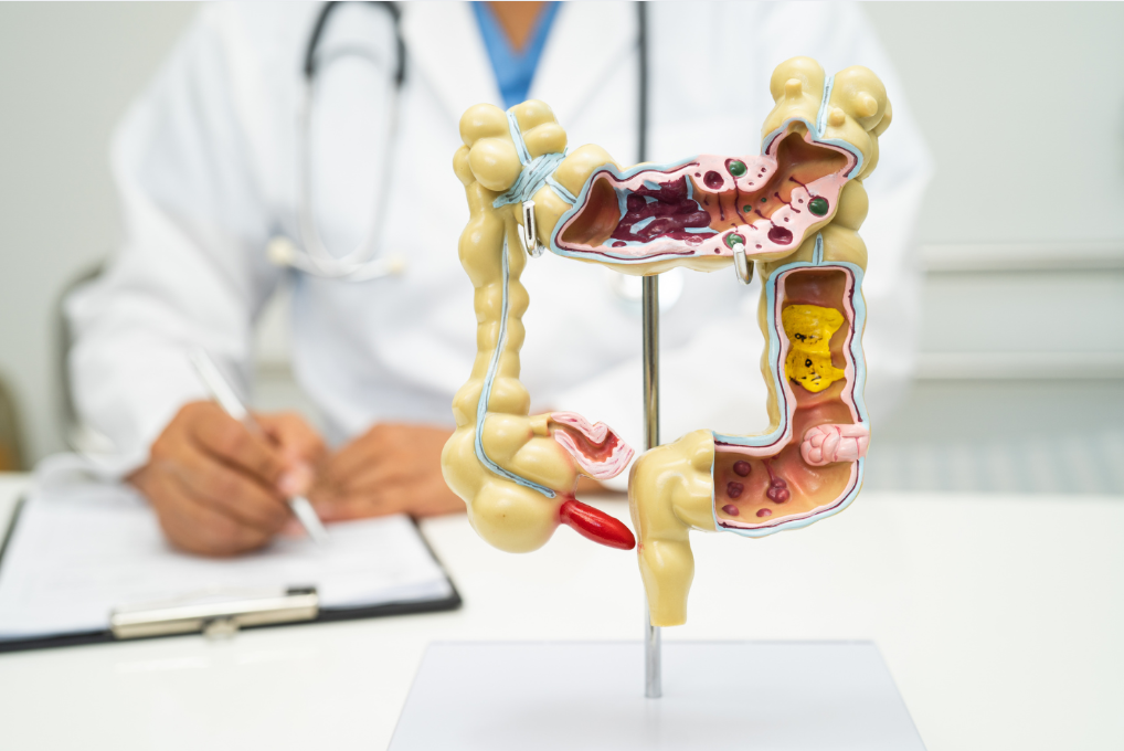 Especialista explicando un modelo anatómico del intestino