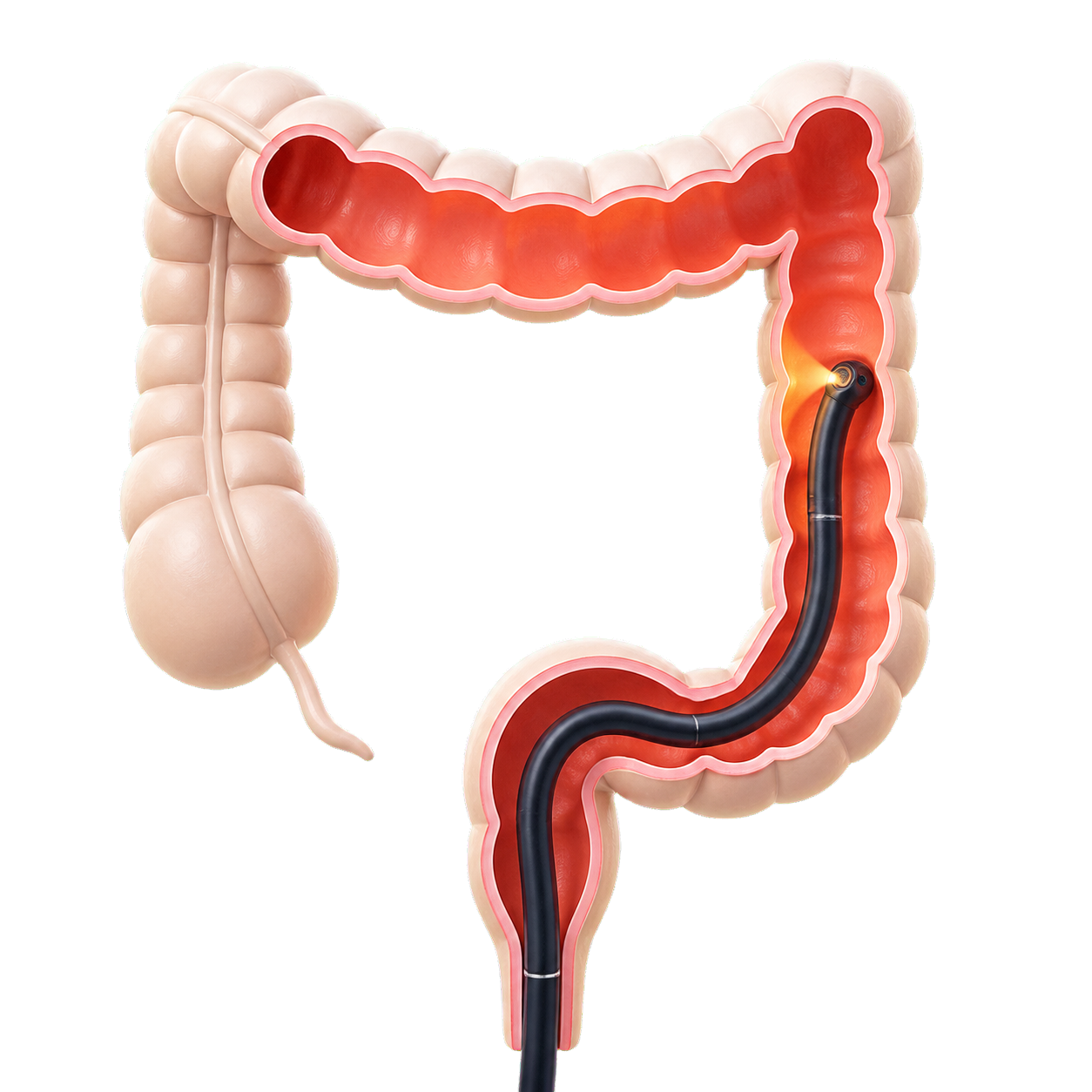 colonoscopia?