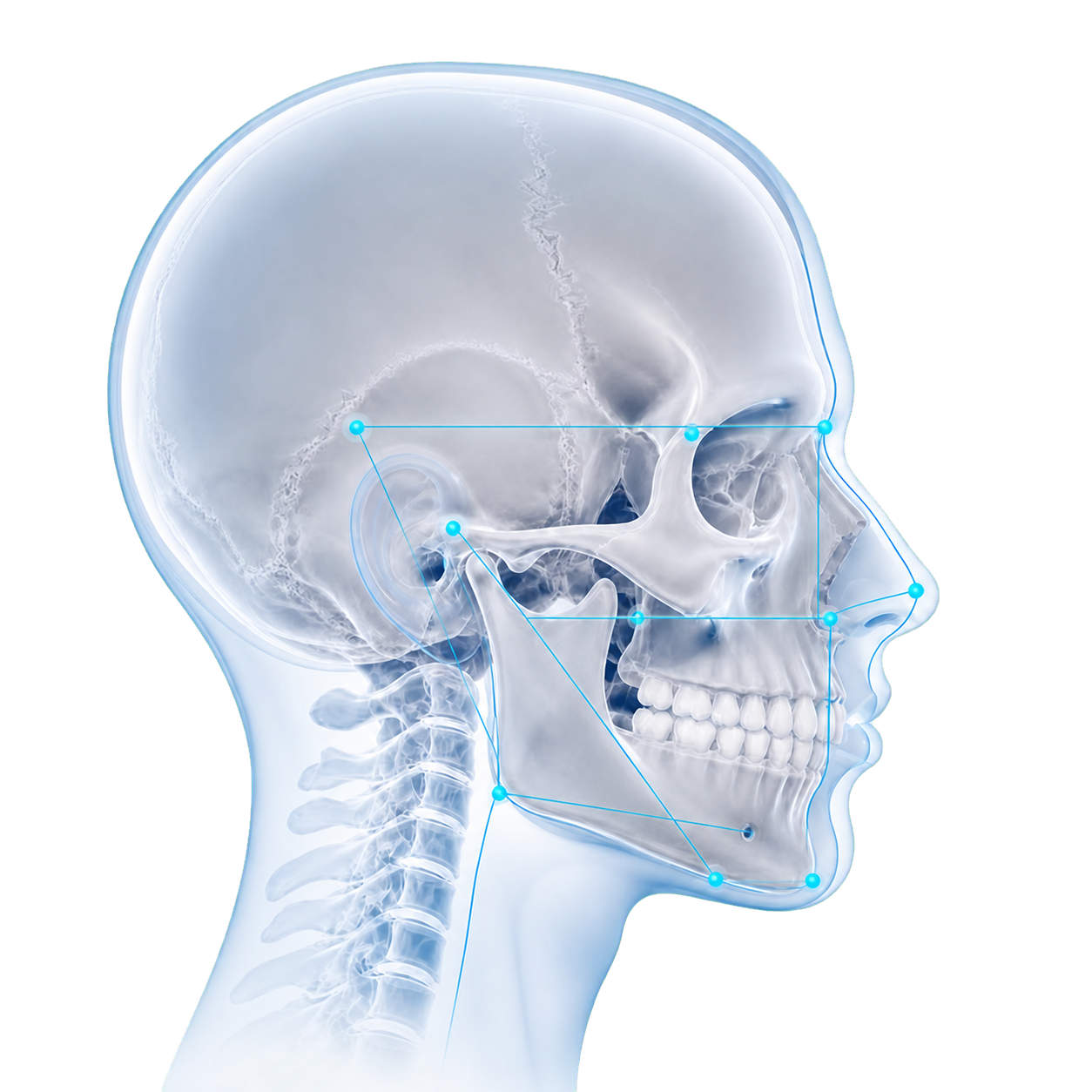 Teleradiografía lateral con análisis cefalométrico